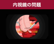 内視鏡の問題